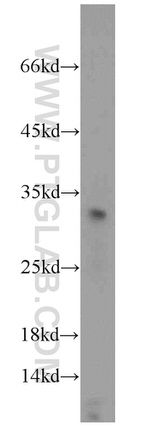 TSPAN1 Antibody in Western Blot (WB)