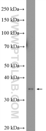 TSPAN1 Antibody in Western Blot (WB)