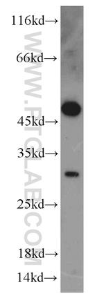 TSPAN1 Antibody in Western Blot (WB)