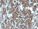 NMD3 Antibody in Immunohistochemistry (Paraffin) (IHC (P))