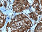 NMD3 Antibody in Immunohistochemistry (Paraffin) (IHC (P))