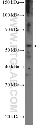CYP39A1 Antibody in Western Blot (WB)