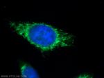 PMPCB Antibody in Immunocytochemistry (ICC/IF)