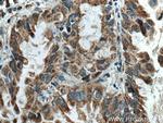 PMPCB Antibody in Immunohistochemistry (Paraffin) (IHC (P))