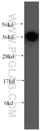 RDH13 Antibody in Western Blot (WB)