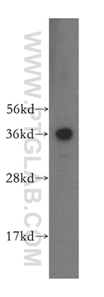 RDH13 Antibody in Western Blot (WB)