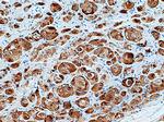 GCDFP-15/PIP Antibody in Immunohistochemistry (Paraffin) (IHC (P))