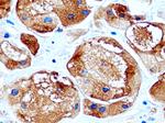 GCDFP-15/PIP Antibody in Immunohistochemistry (Paraffin) (IHC (P))