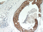 GCDFP-15/PIP Antibody in Immunohistochemistry (Paraffin) (IHC (P))