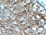 GCDFP-15/PIP Antibody in Immunohistochemistry (Paraffin) (IHC (P))