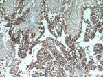 GCDFP-15/PIP Antibody in Immunohistochemistry (Paraffin) (IHC (P))