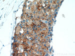 GCDFP-15/PIP Antibody in Immunohistochemistry (Paraffin) (IHC (P))