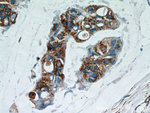 GCDFP-15/PIP Antibody in Immunohistochemistry (Paraffin) (IHC (P))