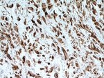 GCDFP-15/PIP Antibody in Immunohistochemistry (Paraffin) (IHC (P))