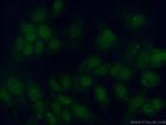 PIAS2 Antibody in Immunocytochemistry (ICC/IF)