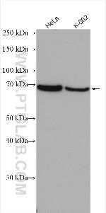 PIAS2 Antibody in Western Blot (WB)