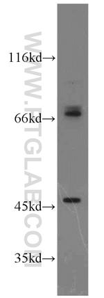 PIAS2 Antibody in Western Blot (WB)