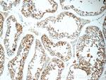 TCN1 Antibody in Immunohistochemistry (Paraffin) (IHC (P))