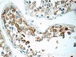 TCN1 Antibody in Immunohistochemistry (Paraffin) (IHC (P))