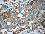 TrpRS Antibody in Immunohistochemistry (Paraffin) (IHC (P))