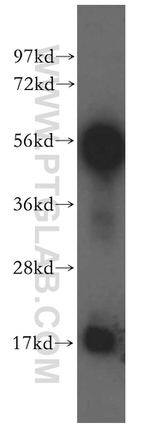 TrpRS Antibody in Western Blot (WB)