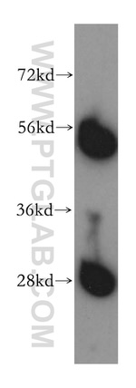 TrpRS Antibody in Western Blot (WB)