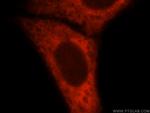 TrpRS Antibody in Immunocytochemistry (ICC/IF)