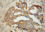 TrpRS Antibody in Immunohistochemistry (Paraffin) (IHC (P))