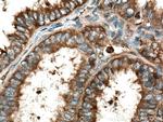 TrpRS Antibody in Immunohistochemistry (Paraffin) (IHC (P))