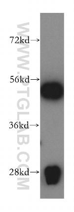 TrpRS Antibody in Western Blot (WB)