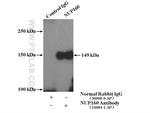 NUP160 Antibody in Immunoprecipitation (IP)
