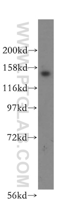 NUP160 Antibody in Western Blot (WB)