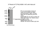 TCTN3 Antibody in Immunoprecipitation (IP)