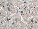 RPL23 Antibody in Immunohistochemistry (Paraffin) (IHC (P))