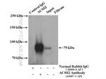 Acetyl CoA synthetase Antibody in Immunoprecipitation (IP)