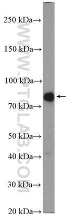 Acetyl CoA synthetase Antibody in Western Blot (WB)