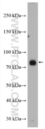 Acetyl CoA synthetase Antibody in Western Blot (WB)