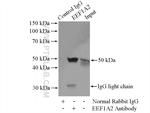 EEF1A2 Antibody in Immunoprecipitation (IP)