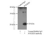 POLR2D Antibody in Immunoprecipitation (IP)