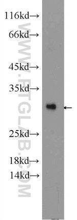 BRMS1 Antibody in Western Blot (WB)