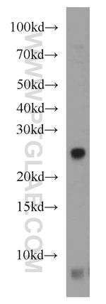 NUDT8 Antibody in Western Blot (WB)