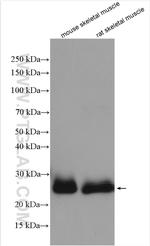 TNNI1 Antibody in Western Blot (WB)