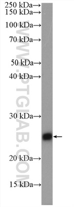 TNNI1 Antibody in Western Blot (WB)