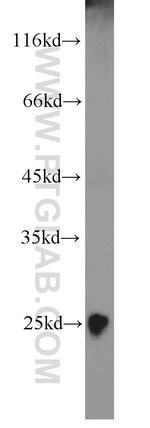 TNNI1 Antibody in Western Blot (WB)