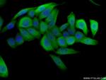 S100A4 Antibody in Immunocytochemistry (ICC/IF)