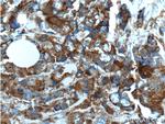 S100A4 Antibody in Immunohistochemistry (Paraffin) (IHC (P))