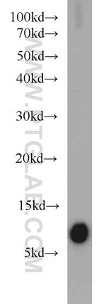 S100A4 Antibody in Western Blot (WB)