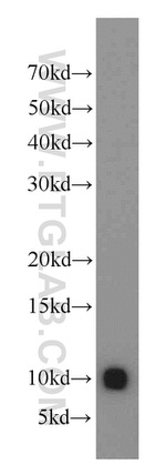 S100A4 Antibody in Western Blot (WB)