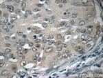 HSF1 Antibody in Immunohistochemistry (Paraffin) (IHC (P))