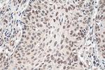 HSF1 Antibody in Immunohistochemistry (Paraffin) (IHC (P))